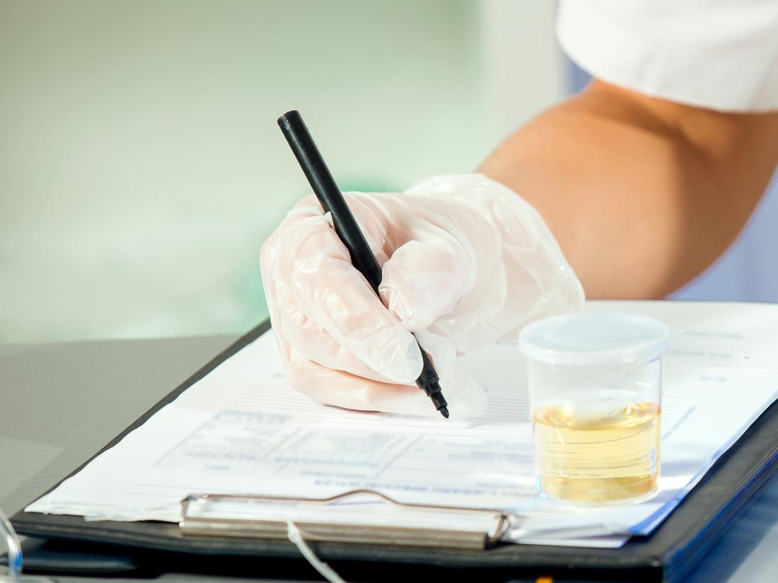 do cigarettes show up on a drug test Will CBD Cigarettes Cause You to Fail a Drug Test? How to Pass? – Wild Hemp do cigarettes show up on a drug test Will CBD Cigarettes Cause You to Fail a Drug Test? How to Pass? – Wild Hemp